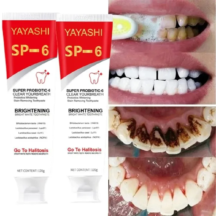 SP 6 Probiotic Brightening Toothpaste Oral Care Of Refreshing Breath With Toothpaste And Probiotics Teeth Whitening 120g