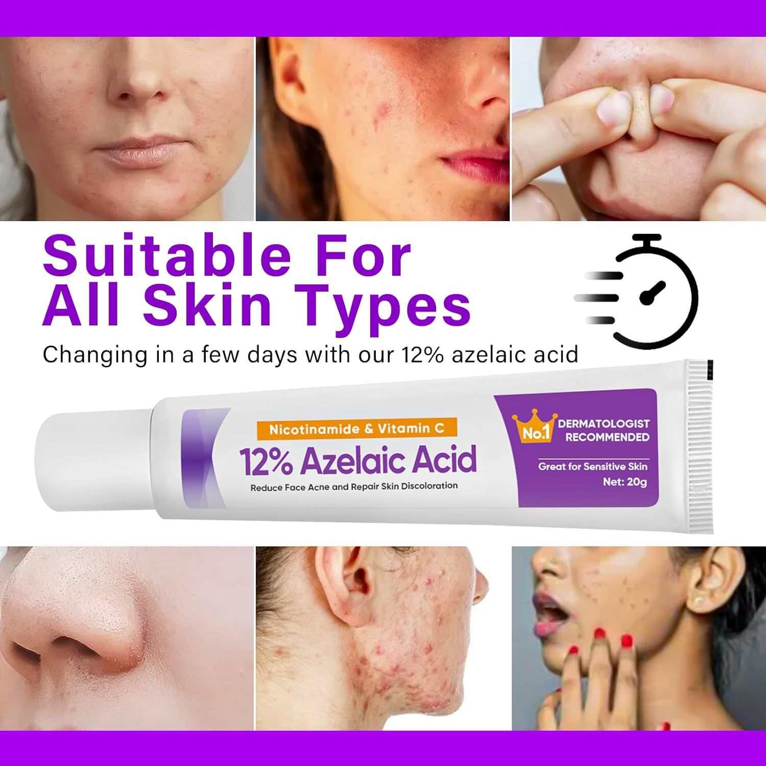 Azelaic Acid 12% Serum Azelaic Acid Cream Nicotinamide Serum Smooth Skin Azelaic Acid 12% Serum Cream Facial Redness