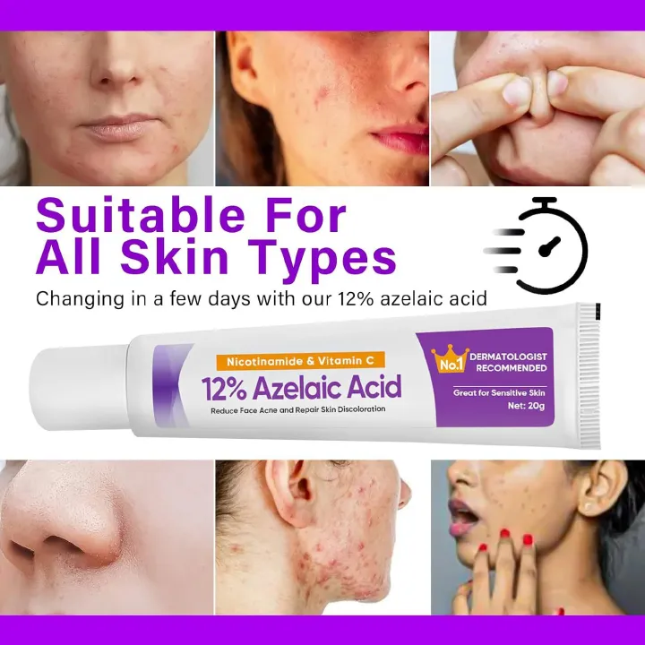 Azelaic Acid 12% Serum Azelaic Acid Cream Nicotinamide Serum Smooth Skin Azelaic Acid 12% Serum Cream Facial Redness