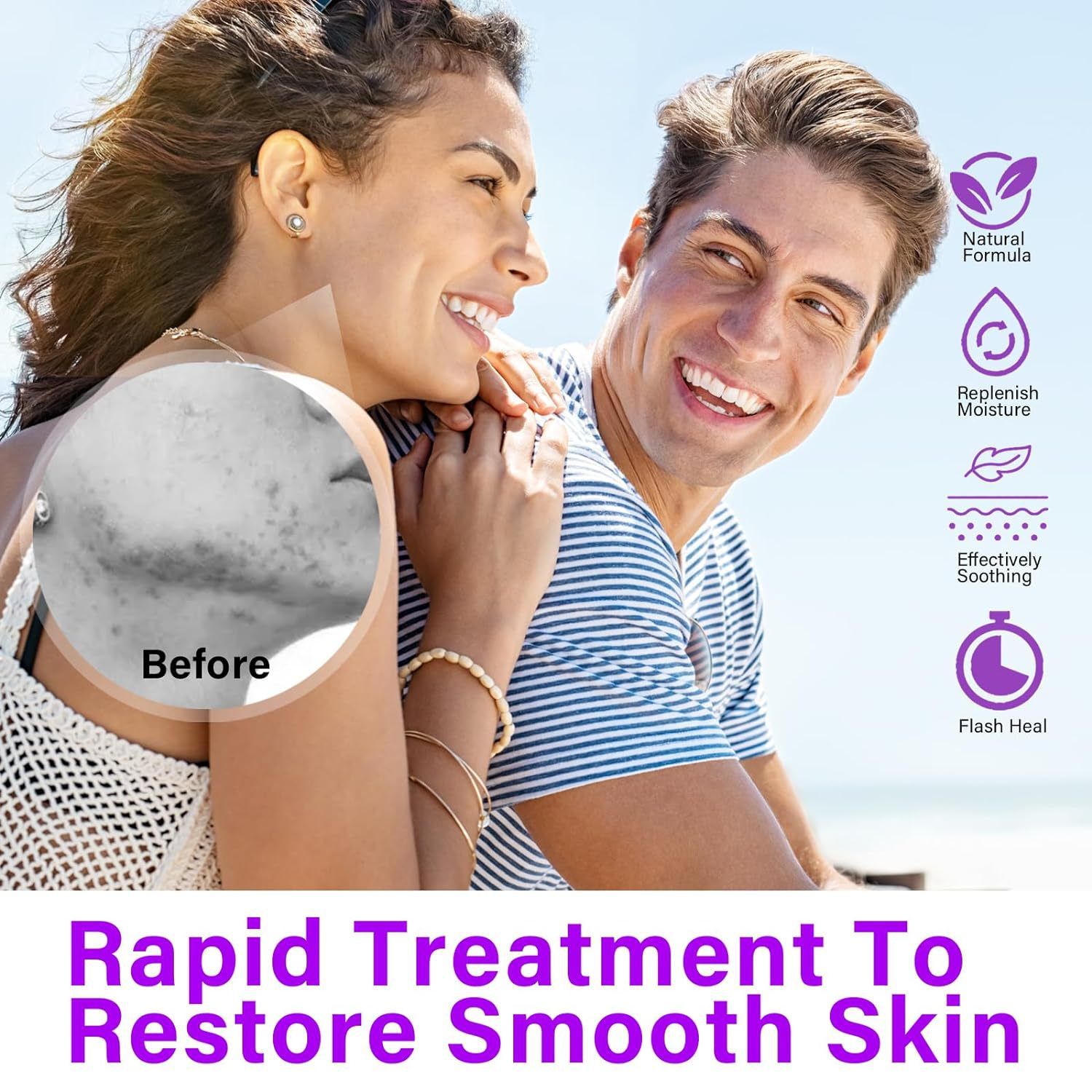 Azelaic Acid 12% Serum Azelaic Acid Cream Nicotinamide Serum Smooth Skin Azelaic Acid 12% Serum Cream Facial Redness