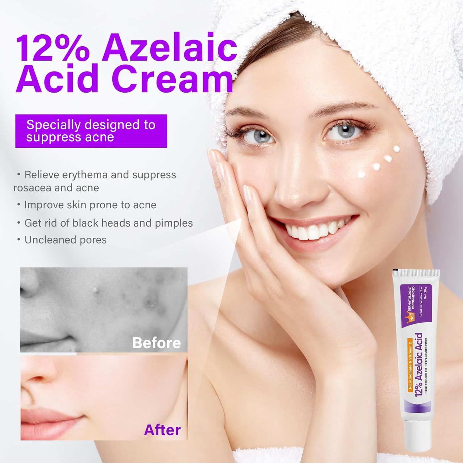 Azelaic Acid 12% Serum Azelaic Acid Cream Nicotinamide Serum Smooth Skin Azelaic Acid 12% Serum Cream Facial Redness