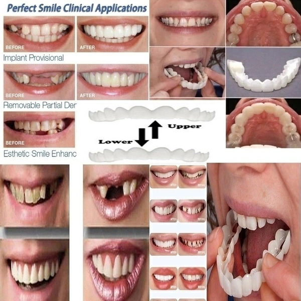 Veneer Snap-on Teeth Kit Fake Temporary Tooth Whitening Replacement Temporary Tooth Replacement White Snap Repair Fitting Kit