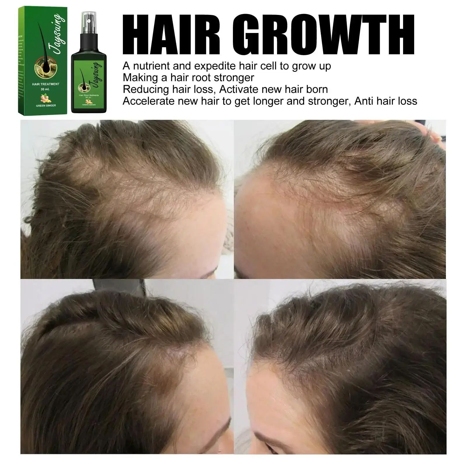 Fast Ginger Hair Growth Spray Roots Grow Anti Hair Loss Hair Regrowth Serum Scalp Damaged Repair Nourish Care Products Women Men