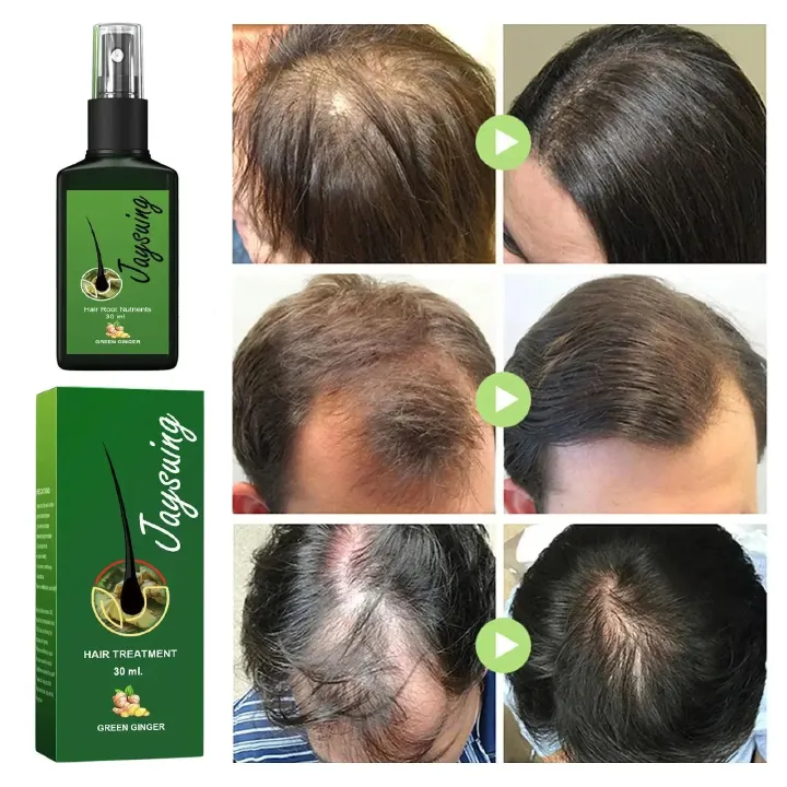 Fast Ginger Hair Growth Spray Roots Grow Anti Hair Loss Hair Regrowth Serum Scalp Damaged Repair Nourish Care Products Women Men