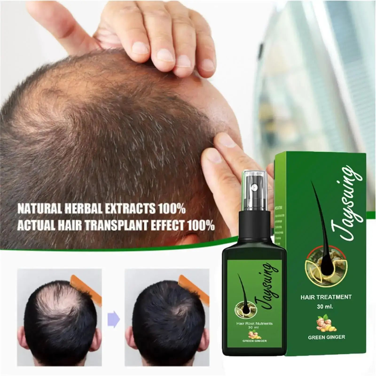 Fast Ginger Hair Growth Spray Roots Grow Anti Hair Loss Hair Regrowth Serum Scalp Damaged Repair Nourish Care Products Women Men