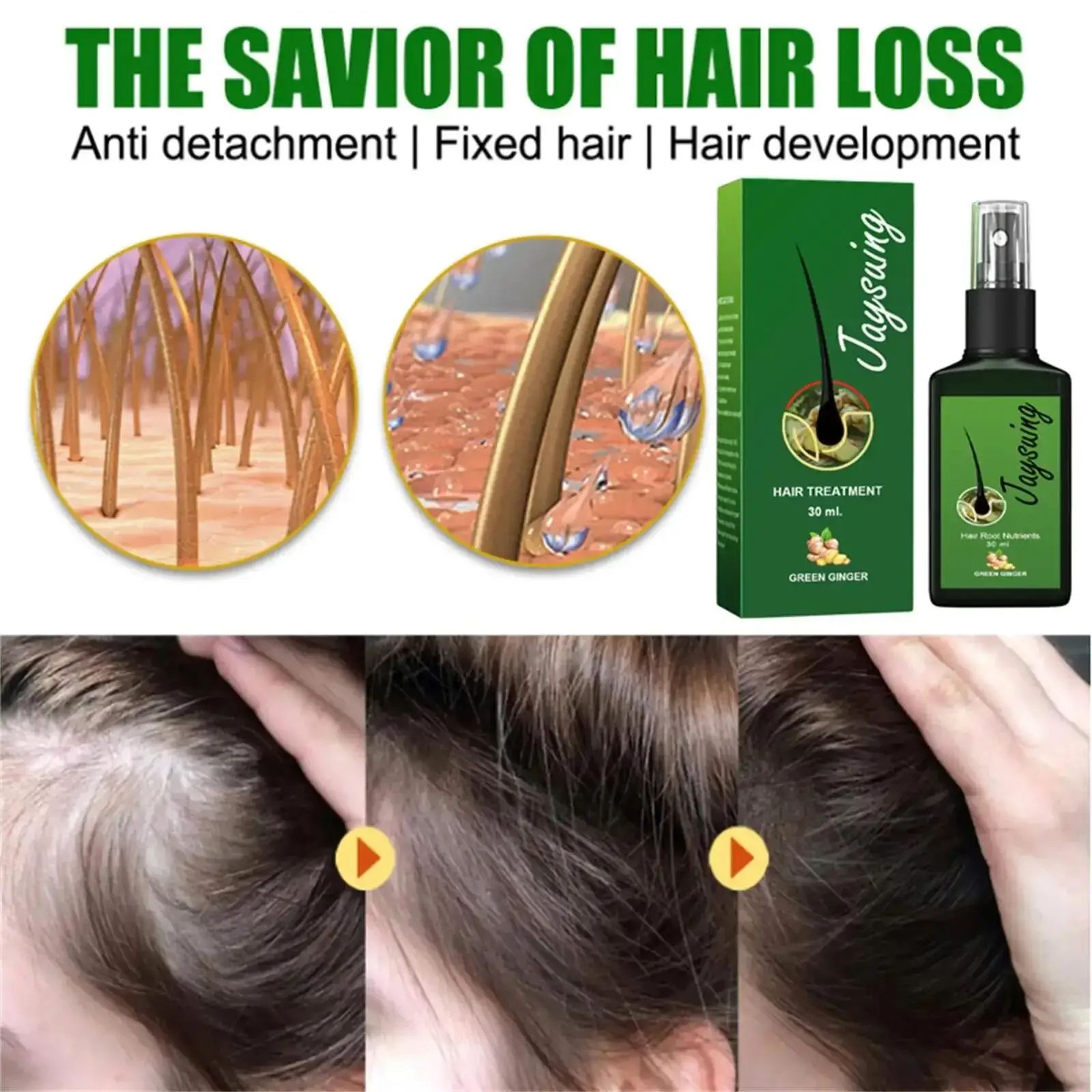 Fast Ginger Hair Growth Spray Roots Grow Anti Hair Loss Hair Regrowth Serum Scalp Damaged Repair Nourish Care Products Women Men