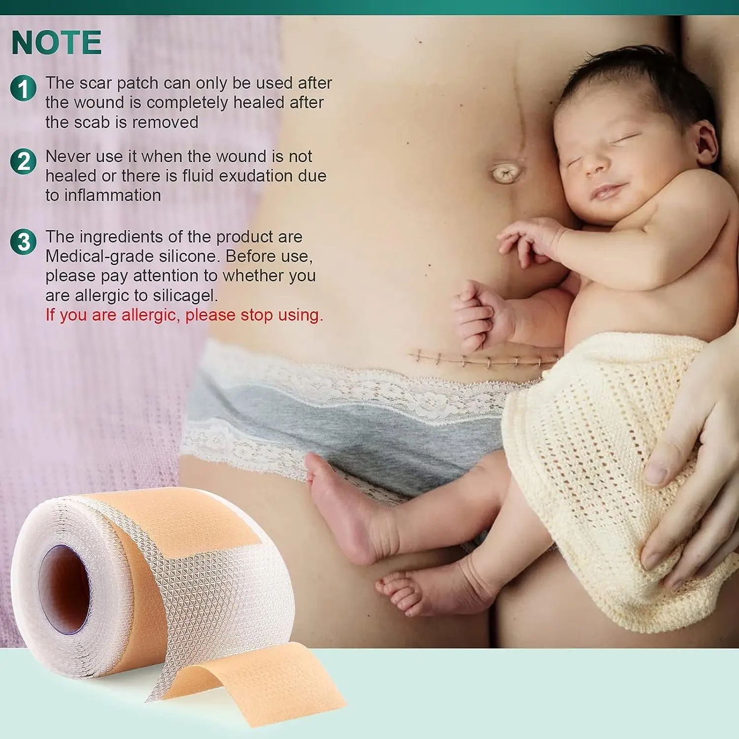 4*10/15/50/150cm Silicone Gel Scar Sheet Patch Treatment Removal Tape Acne Trauma Burn Scar Cover Skin Repair Section Ear Beauty