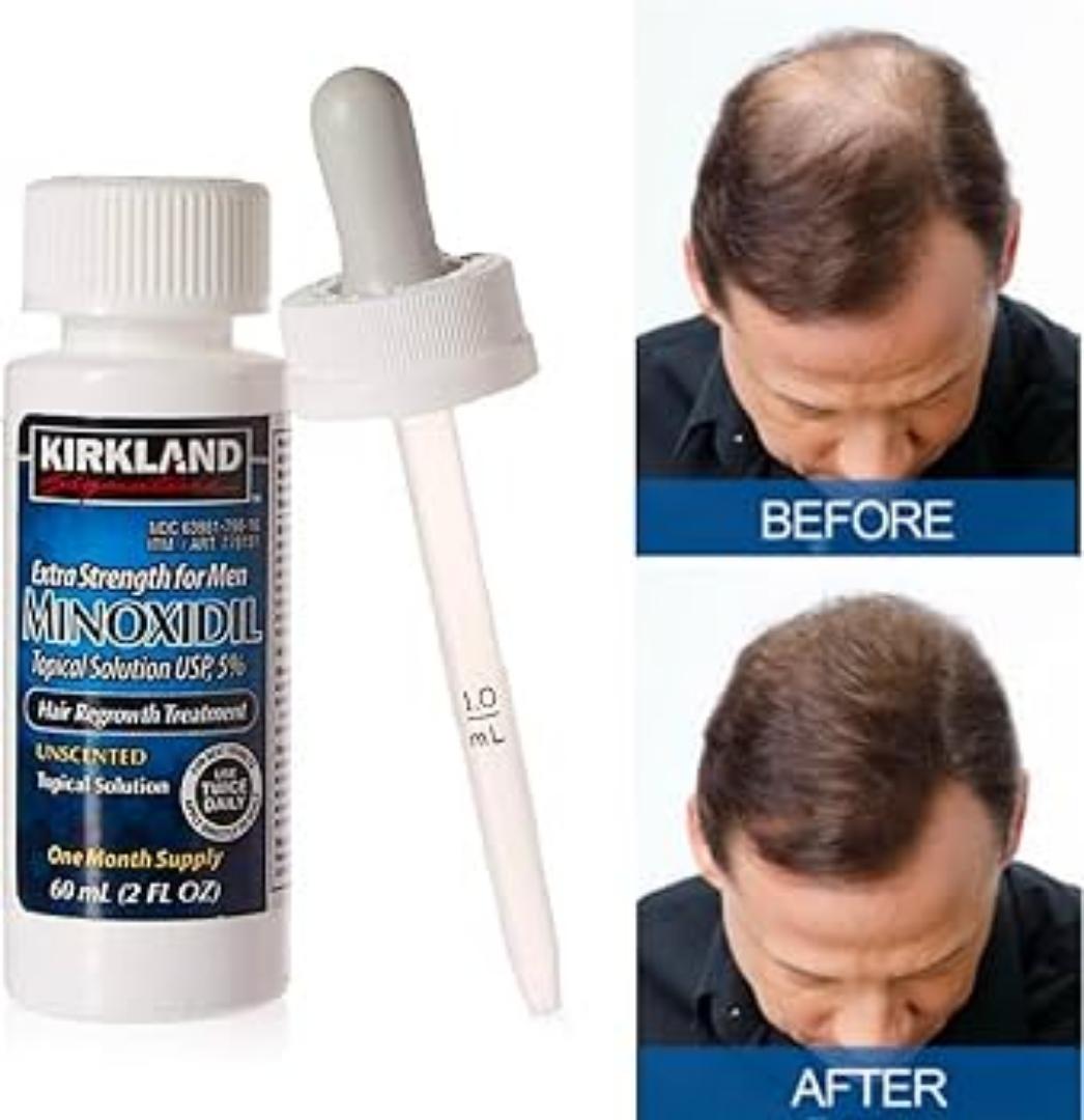 Kirkland Minoxidil 5% Extra Strength Hair Regrowth 1 MonthMinoxidil Topical Solution USP 5% for men, is a topical treatment used to help regrow hair on the top of the scalp.  This unscented product re
