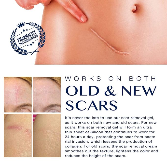 Advanced Scar Gel Medical-Grade Silicone for Face, Body, Stretch Marks, C-Sections, Surgical, Burn, Acne, Old & New Scars