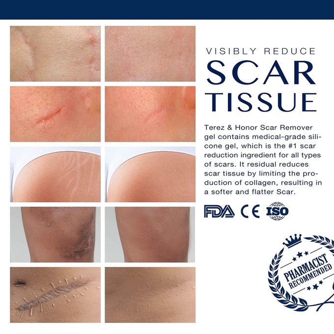 Advanced Scar Gel Medical-Grade Silicone for Face, Body, Stretch Marks, C-Sections, Surgical, Burn, Acne, Old & New Scars