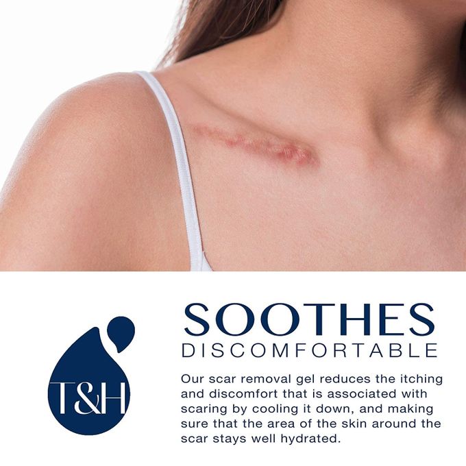 Advanced Scar Gel Medical-Grade Silicone for Face, Body, Stretch Marks, C-Sections, Surgical, Burn, Acne, Old & New Scars