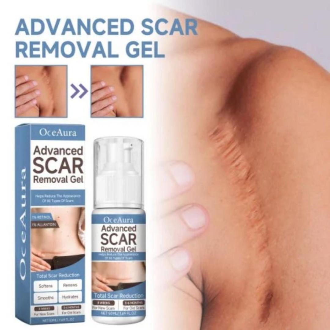 Advanced Scar Gel Medical-Grade Silicone for Face, Body, Stretch Marks, C-Sections, Surgical, Burn, Acne, Old & New Scars