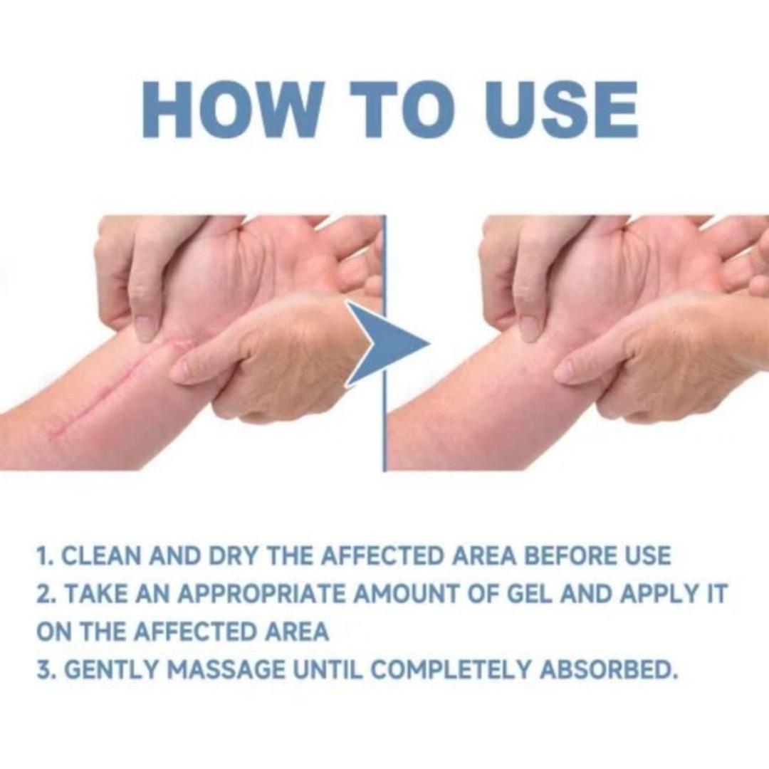 Advanced Scar Gel Medical-Grade Silicone for Face, Body, Stretch Marks, C-Sections, Surgical, Burn, Acne, Old & New Scars