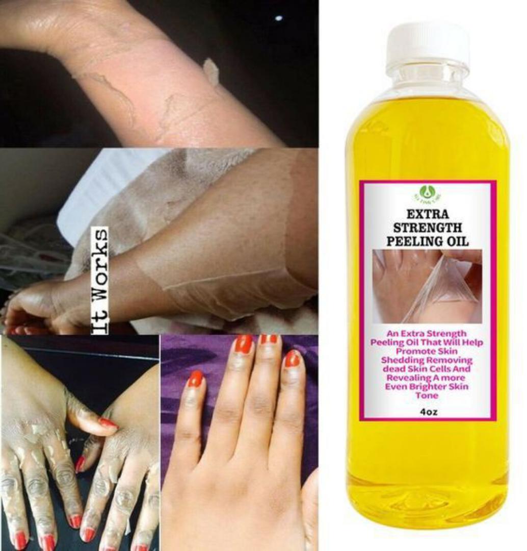Peeling Oil for Dark Skin, Yellow Peeling Oil, Strong Peeling Oil Extra Strength, Exfoliating Peeling Solution for Body All Skin Type