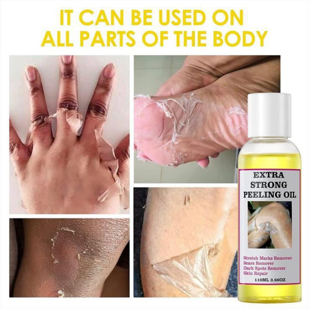 Peeling Oil for Dark Skin, Yellow Peeling Oil, Strong Peeling Oil Extra Strength, Exfoliating Peeling Solution for Body All Skin Type