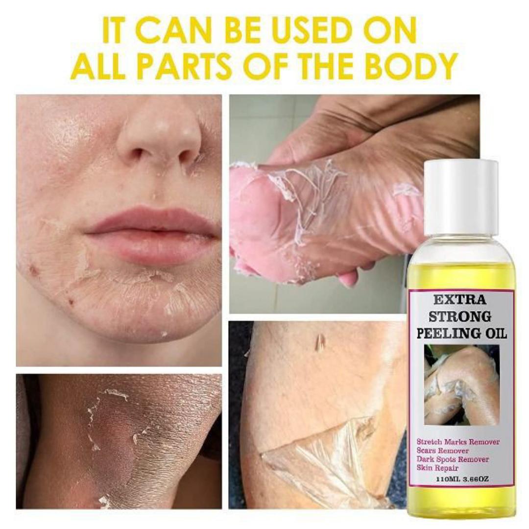 Peeling Oil for Dark Skin, Yellow Peeling Oil, Strong Peeling Oil Extra Strength, Exfoliating Peeling Solution for Body All Skin Type