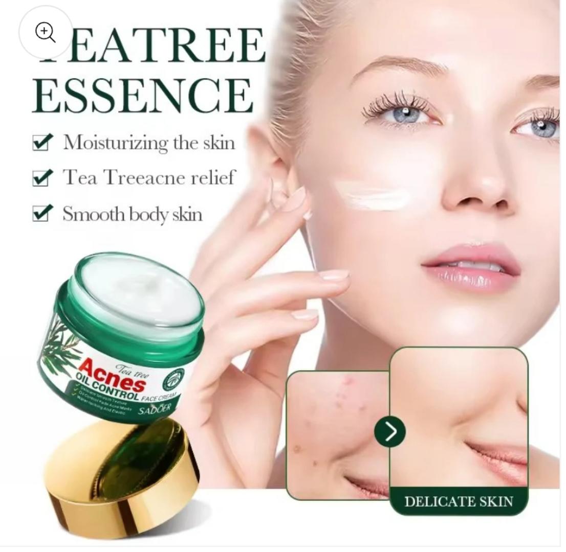 Acne Oil Control Face Cream |Pimple Remover Cream, Get Rid of Pimples Fast for Oily and Acne Prone Skin, Cruelty Free- 50g