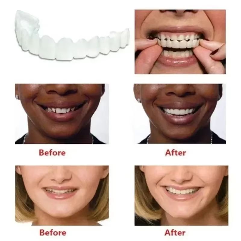 Upper Lower Fake Teeth Cover Perfect Bright Veneers Comfort Fit Flex Dentures Braces Whitening