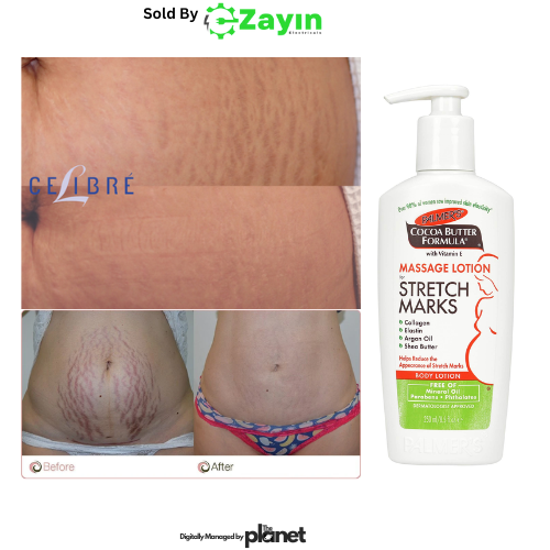 Palmer’s Stretch Mark Lotion
Cocoa Butter Body Lotion
Stretch Marks Moisturizer

Palmer’s Maternity Lotion
Collagen Rich Pregnancy Lotion
Vitamin E Firming Lotion
Argan Oil Stretch Mark Treatment