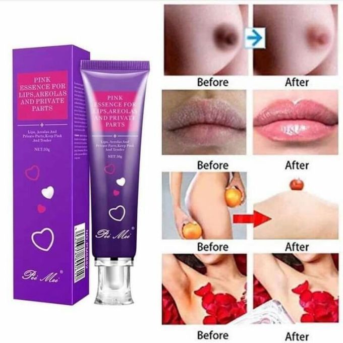 PINK LIPS ESSENCE Dark Smoky Lips Pink Lip Gel Cream Clears Melasma & Hyperpigmentation Toned Rosy Lips (Pink Lip Cream Lip Therapy Lip Essence Sexy Pink Lip Purple Essence)