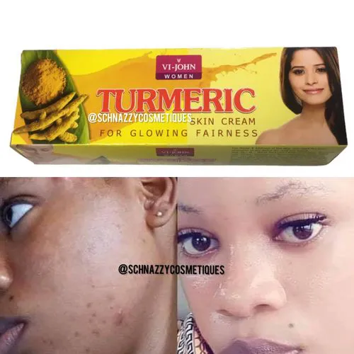 VJ JOHN Turmeric Face Cream for Natural Glow Clear Face Fades Pigmentation Melasma Blemishes Acne Cream