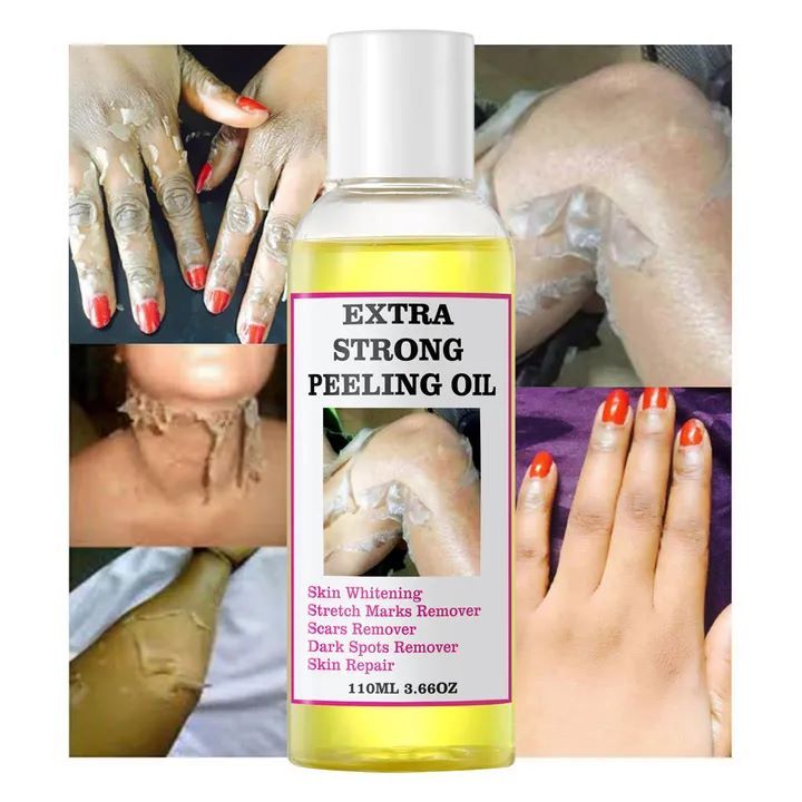 Yellow Peeling Oil Dark Knuckle Treatment Gentle Chemical Peeling Oil Brighten Elbows Knees Hands Melanin Even Skin Tone Brighten Dark Dull Hands Feet and Skin
