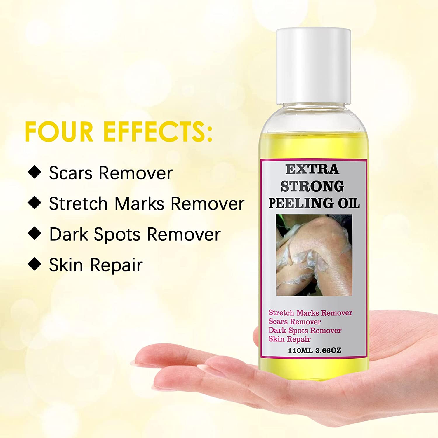Yellow Peeling Oil Dark Knuckle Treatment Gentle Chemical Peeling Oil Brighten Elbows Knees Hands Melanin Even Skin Tone Brighten Dark Dull Hands Feet and Skin