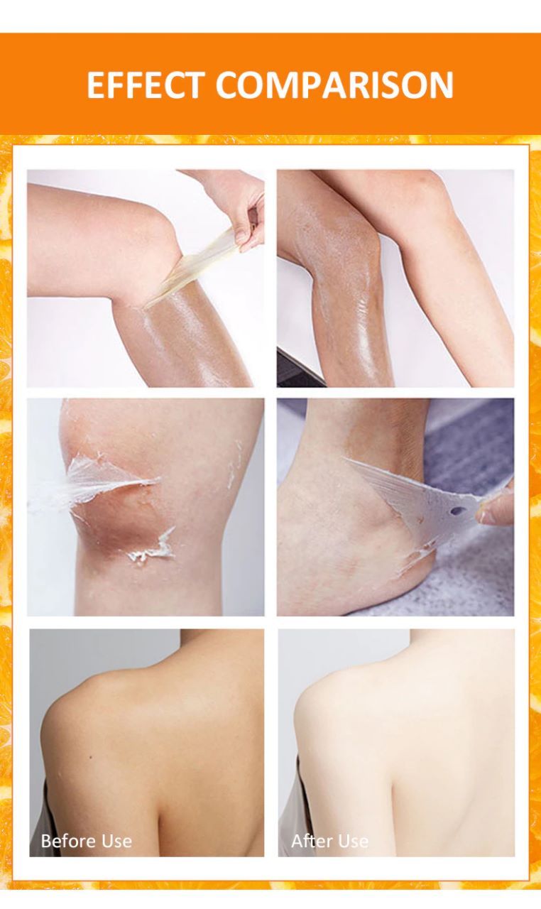 Yellow Peeling Oil Dark Knuckle Treatment Gentle Chemical Peeling Oil Brighten Elbows Knees Hands Melanin Even Skin Tone Brighten Dark Dull Hands Feet and Skin