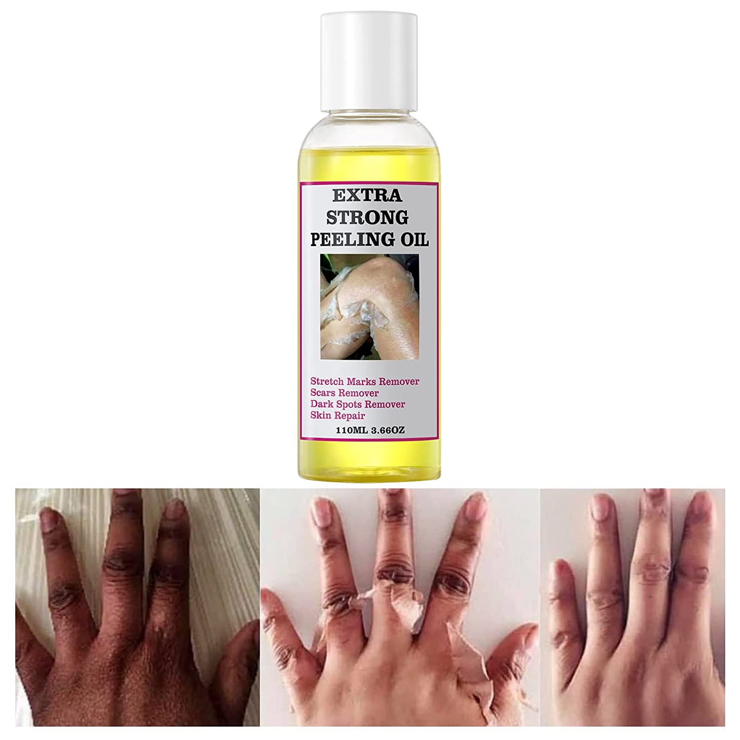 Yellow Peeling Oil Dark Knuckle Treatment Gentle Chemical Peeling Oil Brighten Elbows Knees Hands Melanin Even Skin Tone Brighten Dark Dull Hands Feet and Skin