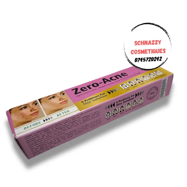 ZERO-ACNE Hydroquinone Mometasone and Tretinoin Cream 6 Problems in 1 Solution : Acne Pimple Marks Pollution Fairness Blemishes 30gms Apply Daily at Bedtime Short Term Treatment Melasma Discolorations