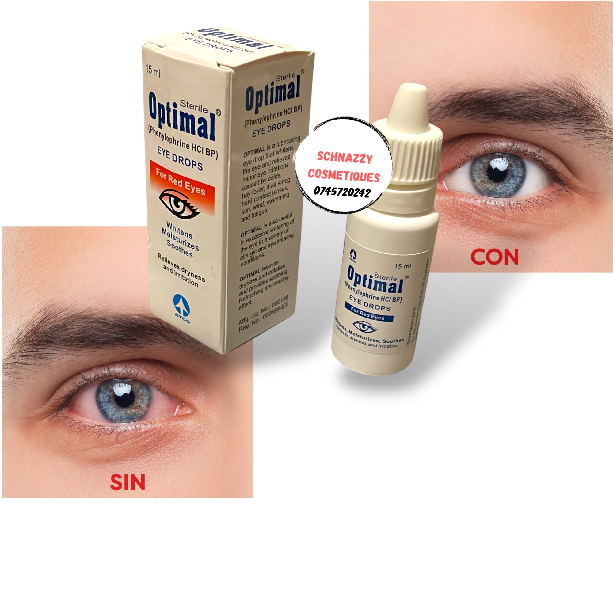 OPTIMAL Sterile Eyedrops for Red Eyes Relieves Dryness Irritation Sensitivity to Dust Light Exhaustion Whitens Moisturises Soothes Brighter Clear Eyes in Secs #eyewhitening