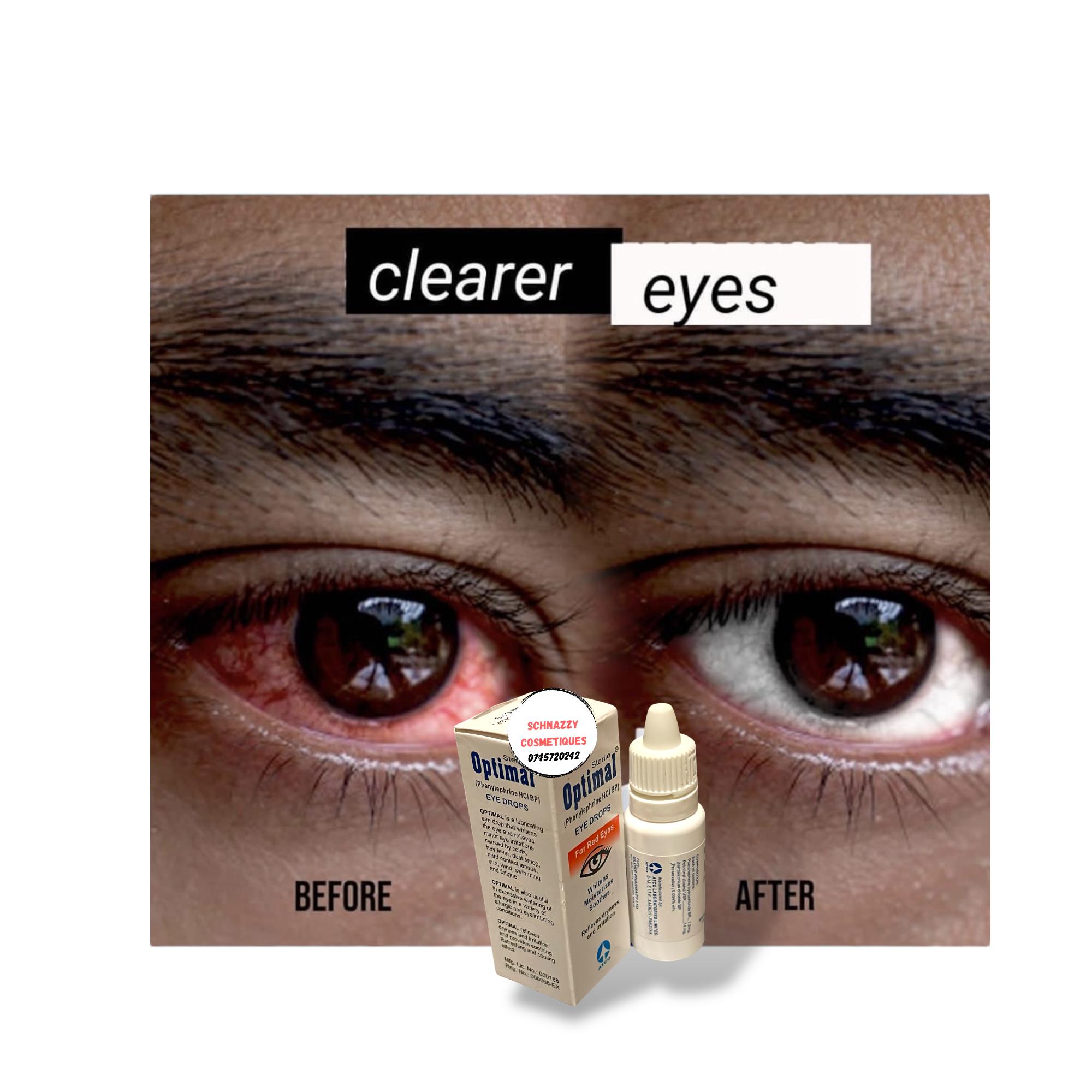 OPTIMAL Sterile Eyedrops for Red Eyes Relieves Dryness Irritation Sensitivity to Dust Light Exhaustion Whitens Moisturises Soothes Brighter Clear Eyes in Secs #eyewhitening