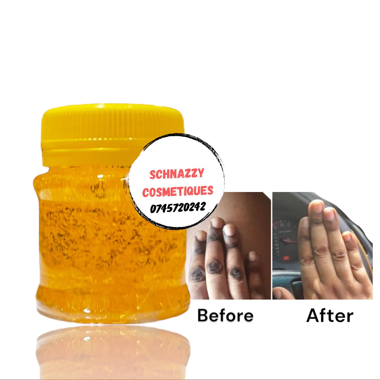 Dark Knuckles Gel Hyperpigmentation Discoloration Fades Stubborn Marks (Not for Face) Elbows Knees Hands Toes Feet Armpits Dark Inner Thighs (KENNITE)