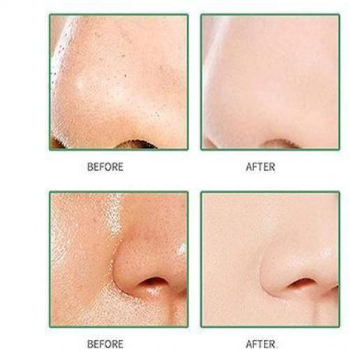 Green Tea Mask Mud Stick Under Eye Blackness Dark Circles Redness Sunburn Antiaging Promote Collagen Skin Clarity Acne Blackhead Smooth Clear Complexion Tighten Pores Clay Stick Mask