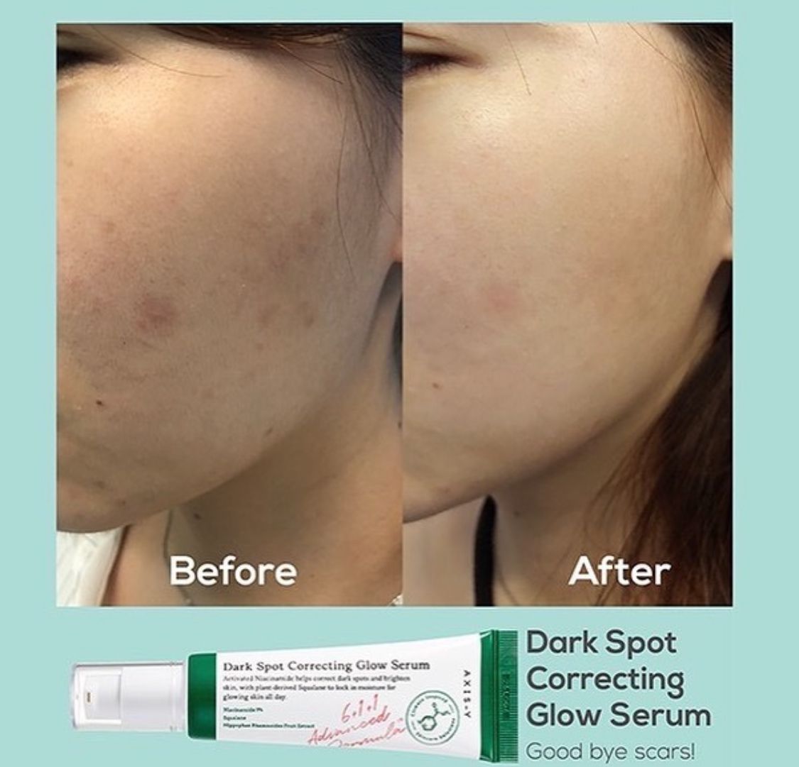 AXIS-Y Dark Spot Correcting Glow Activated Niacinamide Treats Hyperpigmentation Brightens Improves Uneven Skin Tone Squalane to Retain Skin Moisture ( AXIS Y CREAM AXIS Y SERUM)