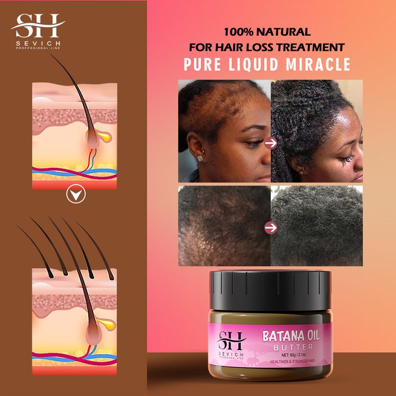 SEVICH 60g Batana Oil Butter 40ml Pure Batana Oil For Hair Growth Treating Hair Loss Anti-Breakage Hair Mask For Men & Women African Traction Alopecia Treatment Beauty Health Hair Care Products