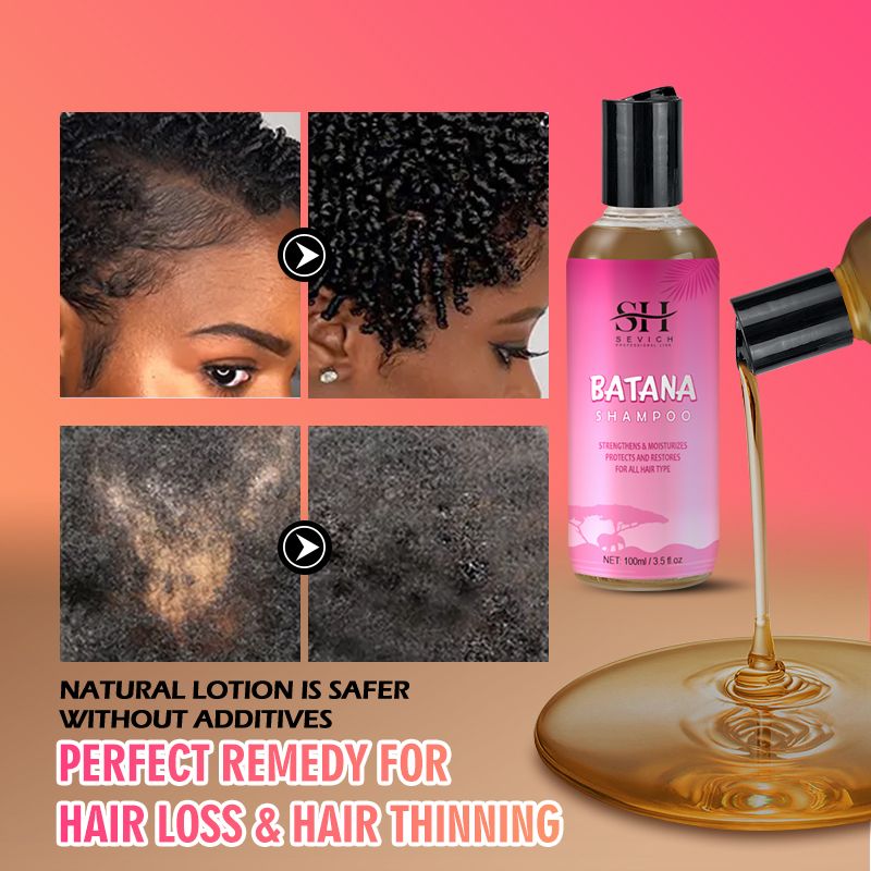 SEVICH 200ml Batana Oil Shampoo Set 100ml African Hair Growth Anti-Hair Loss Shampoo 100ml Batana Hair Repair Conditioner Anti Break Hair Regrowth Treatment Essence Beauty Health Hair Care Products