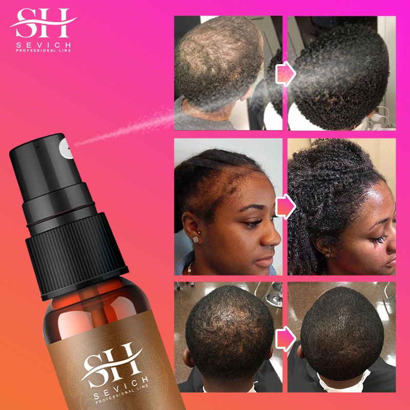 SEVICH Chebe Oil Hair Growth Spray 30ml African Traction Alopecia Chebe Powder Serum Edges Anti Hair Loss Treatment Anti-Breakage Essential Oil Serum Regrowth Thicken Oils Hair Care Beauty Health