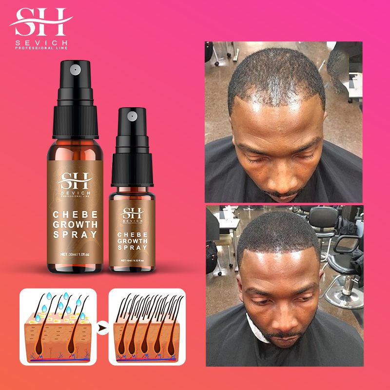 SEVICH Chebe Oil Hair Growth Spray 30ml African Traction Alopecia Chebe Powder Serum Edges Anti Hair Loss Treatment Anti-Breakage Essential Oil Serum Regrowth Thicken Oils Hair Care Beauty Health