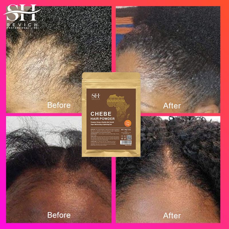 SEVICH Chebe Powder 100g African Traction Alopecia Chebe Powder Essence Edges Anti Hair Loss Treatment Anti-Breakage Essential Serum Regrowth Thicken Oils Hair Care Beauty Health Products