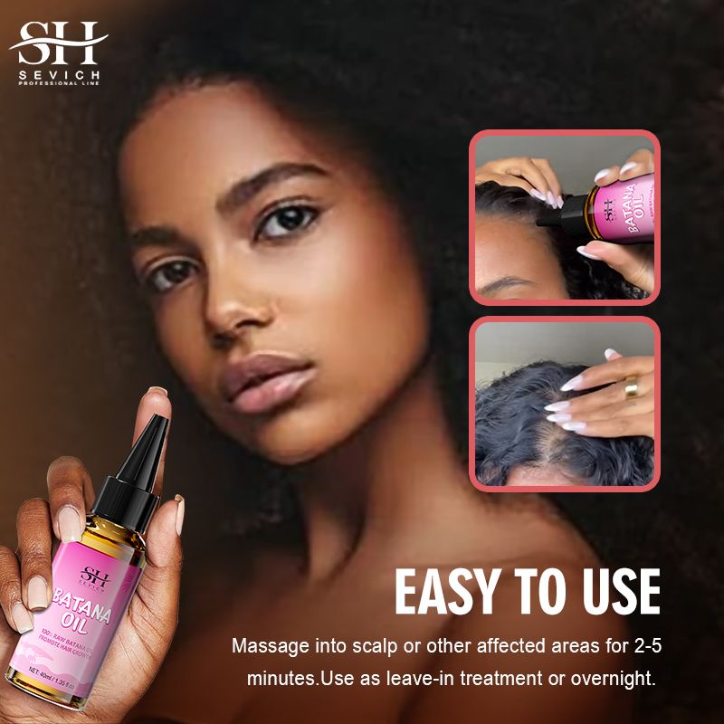 SEVICH 100% Pure Batana Oil For Hair Growth Africa Crazy Traction Alopecia Batana Hair Mask Anti Hair Break Hair Strengthener Hair Loss Treatment Essence For Black Men & Women Batana Oil From Honduras