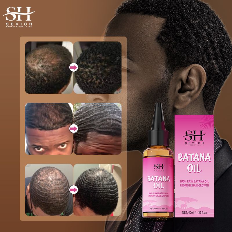 SEVICH 100% Pure Batana Oil For Hair Growth Africa Crazy Traction Alopecia Batana Hair Mask Anti Hair Break Hair Strengthener Hair Loss Treatment Essence For Black Men & Women Batana Oil From Honduras