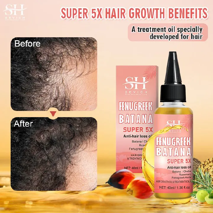 SEVICH Super 5x Batana Oil For Hair Growth Africa Traction Alopecia Treatment Chebe Powder Oil Rosemary Treatment Prevent Hair Loss Serum Essence Liquid Fenugreek Fast Regrowth Thicken Oil Hair Care