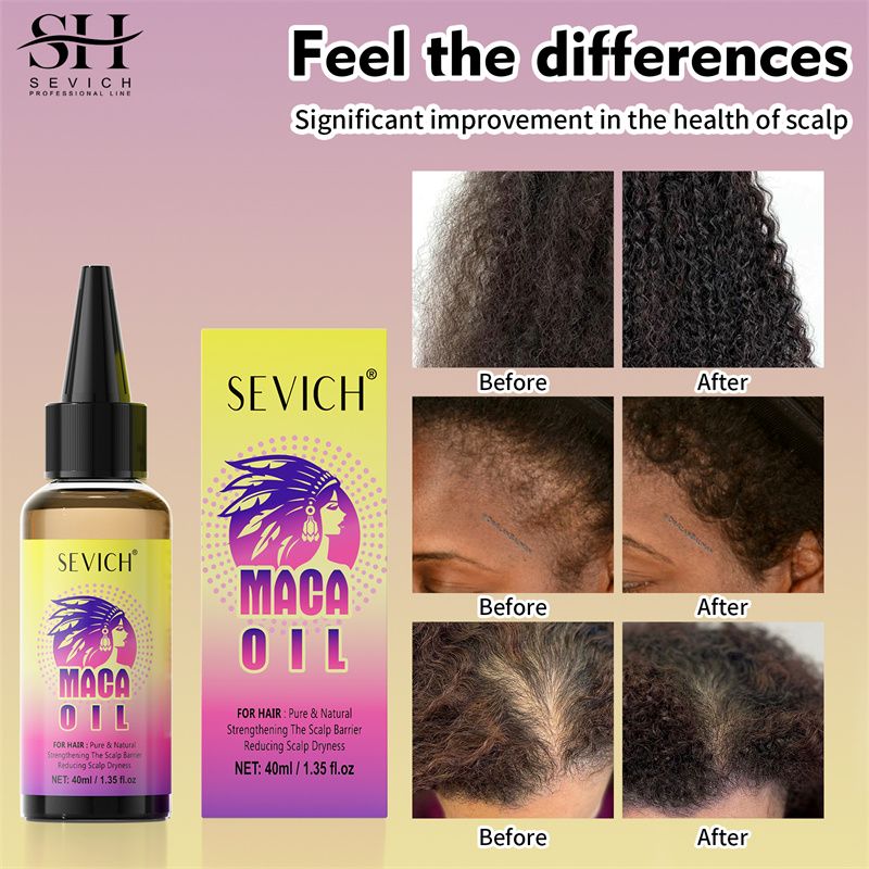 SEVICH Hair Growth Set 40ml Maca Power Hair Growth Oil 120g Maca Powder Butter Hair Mask Castor Oil Maca Root Hair Oil Keratin Anti Hair Loss Hair Care Anti Hair Break Strengthener Treatment Serum
