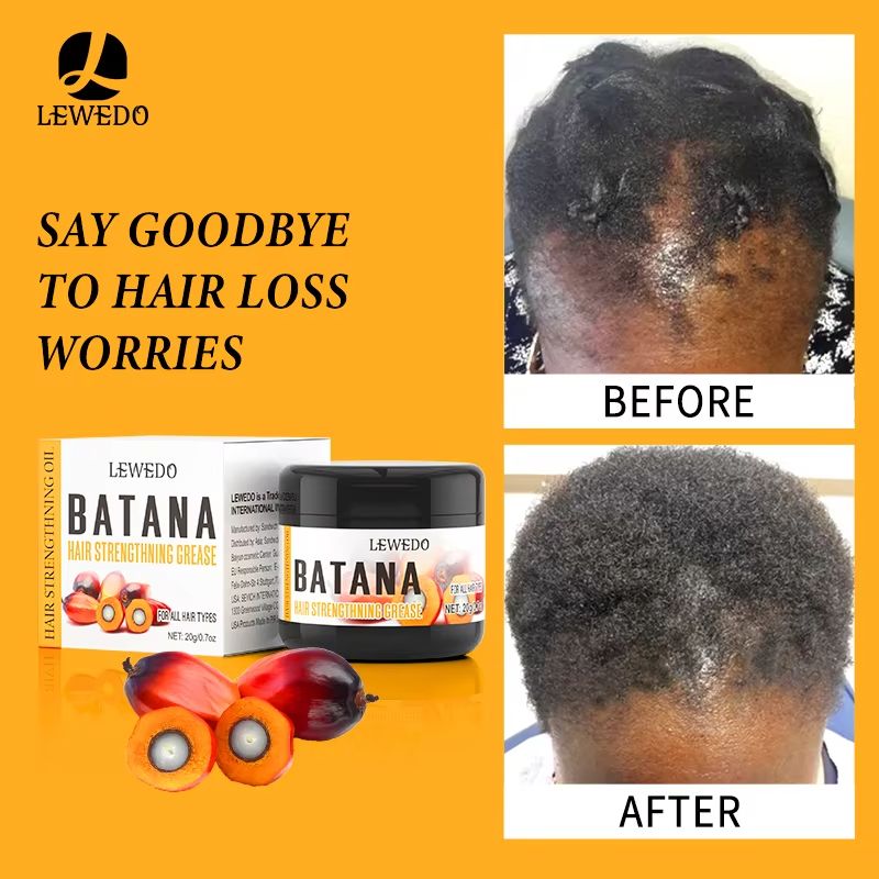 LEWEDO 100% Pure Batana Oil Africa Crazy Traction Alopecia Batana Hair Growth Oil Anti Hair Break Hair Treatment Hair Mask Hair Loss Treatment Hair Regrowth Spray Prevents Hair Loss Hair Care Products
