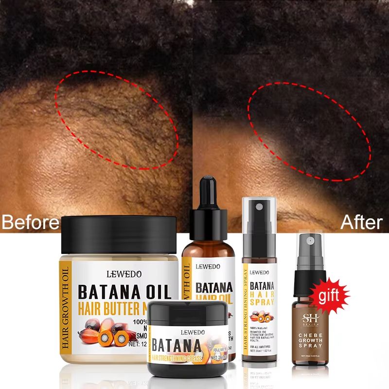 LEWEDO 100% Pure Batana Oil Africa Crazy Traction Alopecia Batana Hair Growth Oil Anti Hair Break Hair Treatment Hair Mask Hair Loss Treatment Hair Regrowth Spray Prevents Hair Loss Hair Care Products