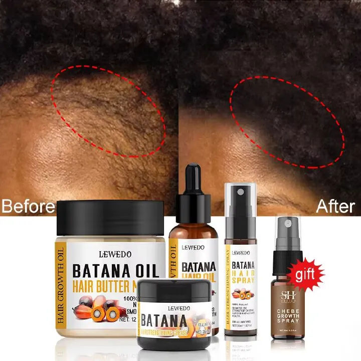 LEWEDO 100% Pure Batana Oil Africa Crazy Traction Alopecia Batana Hair Growth Oil Anti Hair Break Hair Treatment Hair Mask Hair Loss Treatment Hair Regrowth Spray Prevents Hair Loss Hair Care Products