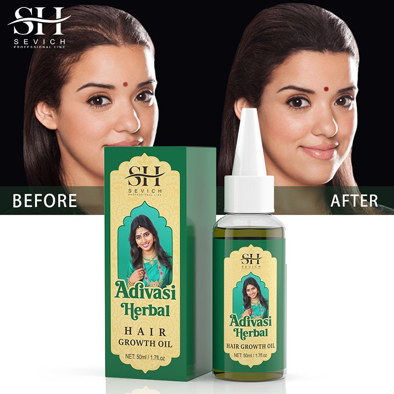 SEVICH 50ml Pure Natural India Hair Oil Ayurvedic Hair Growth Oil Rosemary Hair Growth Oil For Men Hair Regrowth Serum Anti Hair Loss Product Hair Care