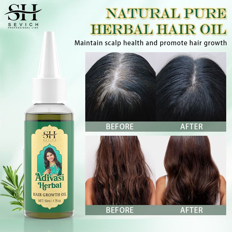 SEVICH 50ml Pure Natural India Hair Oil Ayurvedic Hair Growth Oil Rosemary Hair Growth Oil For Men Hair Regrowth Serum Anti Hair Loss Product Hair Care