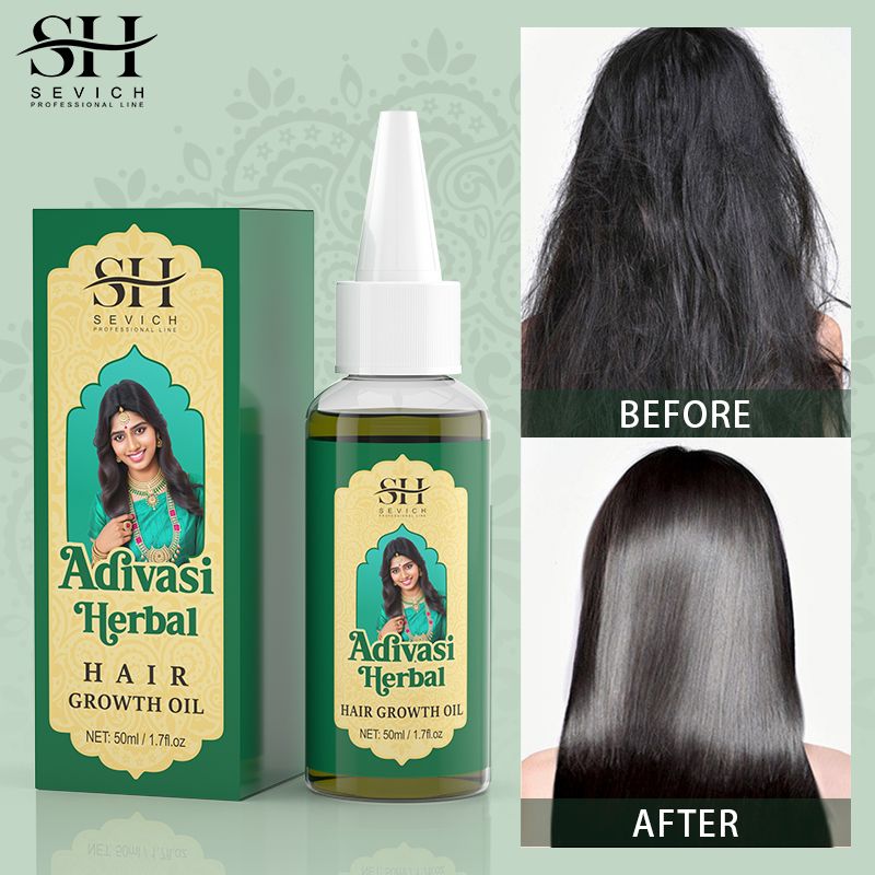 SEVICH 50ml Pure Natural India Hair Oil Ayurvedic Hair Growth Oil Rosemary Hair Growth Oil For Men Hair Regrowth Serum Anti Hair Loss Product Hair Care